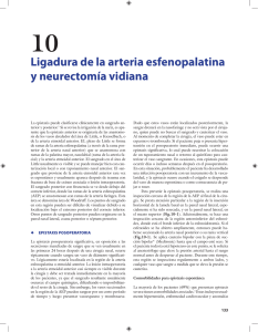 10 Ligadura de la arteria esfenopalatina y neurectomía vidiana