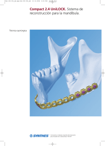 Compact 2.4 UniLOCK. Sistema de reconstrucción para la mandíbula.