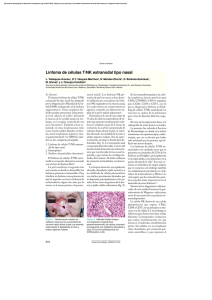 Linfoma de células T/NK extranodal tipo nasal