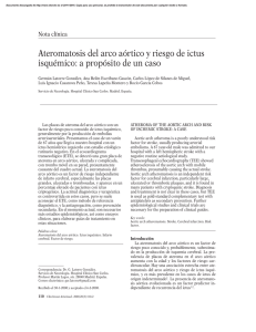 Ateromatosis del arco aórtico y riesgo de ictus isquémico