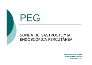 sonda de gastrostomía endoscópica percutánea (peg)