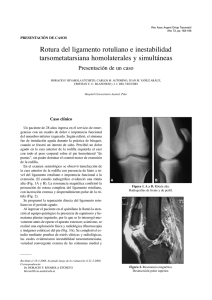 Rotura del ligamento rotuliano e inestabilidad tarsometatarsiana