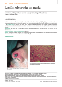 Lesión ulcerada en nariz - Archivos Argentinos de Dermatología