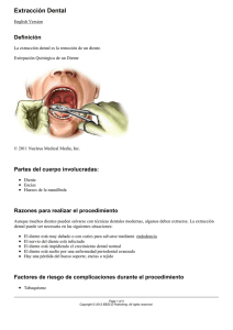 Extracción Dental