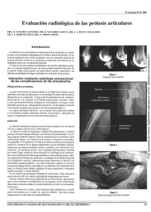 Evaluación radiológica de las prótesis articulares