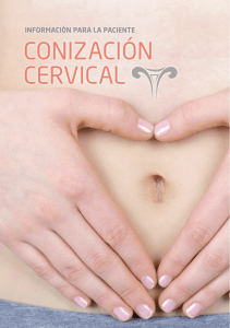 conización cervical