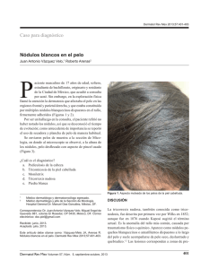 Caso para diagnóstico Nódulos blancos en el pelo