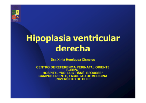 Hipoplasia ventricular derecha