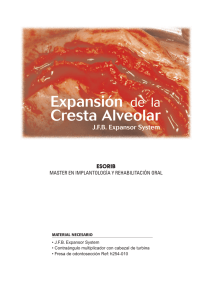 Expansión de la Cresta Alveolar