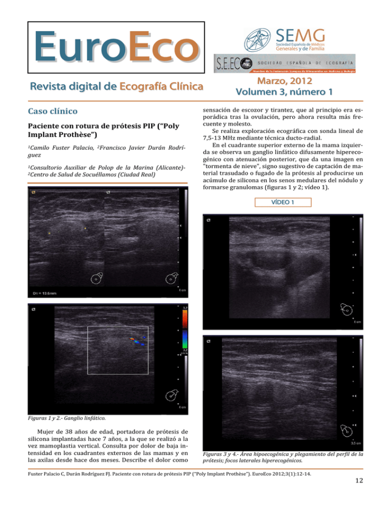 Revista digital de Ecografía Clínica