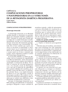 complicaciones peroperatorias y postoperatorias en la vitrectomía