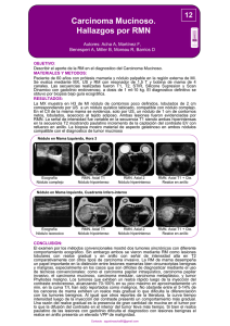 Carcinoma Mucinoso. Hallazgos por RMN 12