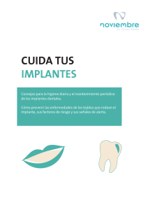 cuida tus implantes - Clinica Dental Noviembre