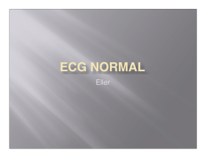 ECG normal 1 - Urgencia UC