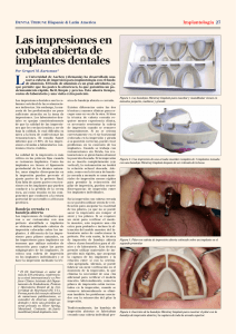 Las impresiones en cubeta abierta de implantes dentales