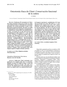 Osteotomía ilíaca de Chiari: conservación funcional de la cadera