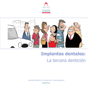 Los Implantes dentales: la tercera dentición