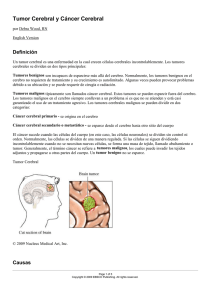 Tumor Cerebral y Cáncer Cerebral
