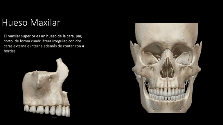 Hueso Maxilar