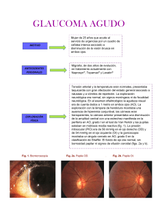 Glaucoma agudo