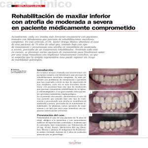 Rehabilitación de maxilar inferior con atrofia de moderada a severa en paciente médicamente comprometido. J. Ortega Muñoz
