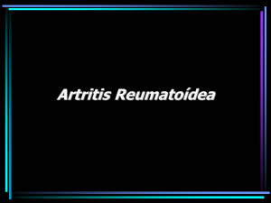 Artritis reumatoídea y Lupus eritematoso generalizado