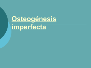 Osteogénesis imperfecta