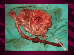 Placenta previa y desprendimiento prematuro de la plancenta