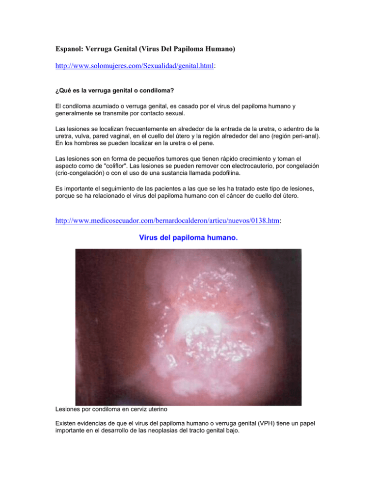 Cancer de uretra femenina sintomas, Cancer de uretra femenino