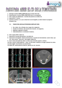 Pasos para abrir la tomografia Simplant