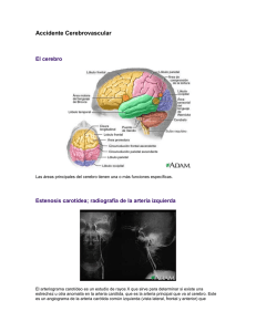 Accidente Cerebrovascular