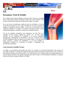 Reemplazo Total de Rodilla