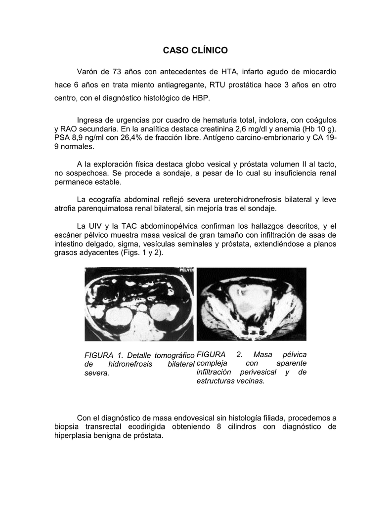 tipo de análisis de sangre para la exploración de creatinina prostática