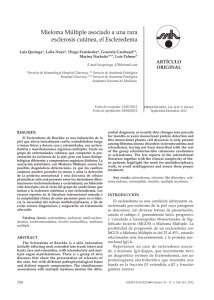 Mieloma Múltiple asociado a una rara esclerosis cutánea, el Escleredema ARTÍCULO ORIGINAL