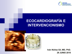 Ecocardiografía e Intervencionismo