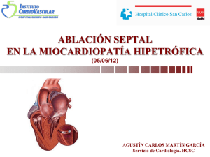 Ablación Septal en la Miocardiopatía Hipertrófica