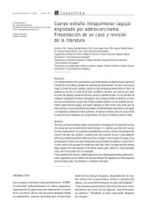 Cuerpo extraño intrapulmonar (aguja) englobado por adenocarcinoma. 88