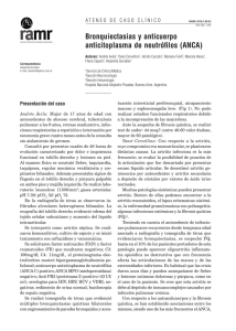 Bronquiectasias y anticuerpo anticitoplasma de neutrófilos (ANCA)