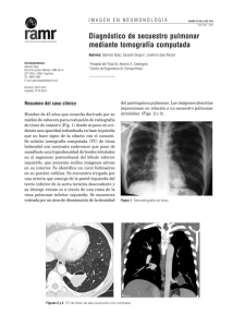 Diagnóstico de secuestro pulmonar mediante tomografía computada