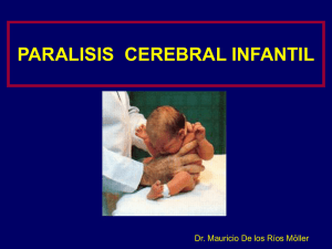 PCI Parálisis cerebral infantil tipos causas y tratamientos