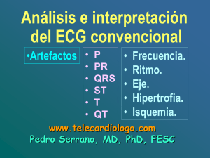 1.2.- InterpretaciÃ³n bÃ¡sica del ECG (segunda clase teÃ³rica sobre el ECG)