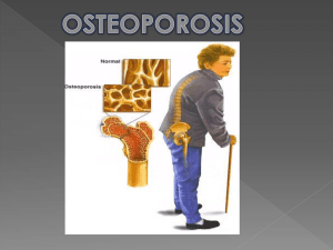 osteoporosi diapositivas