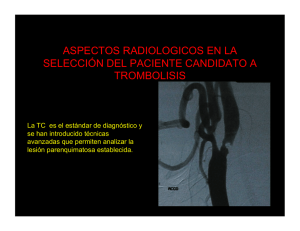 Aspectos-radiológicos-para-Trombòlisis-del