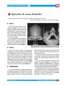 Agenesia de senos frontales - Revista Medicina General y de Familia