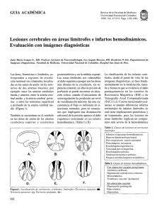 Lesiones cerebrales en áreas limítrofes e infartos hemodinámicos