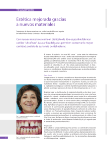 estetica mejorada - Laboratorio innovacion dental