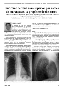 Síndrome de vena cava superior por cables de marcapasos. A