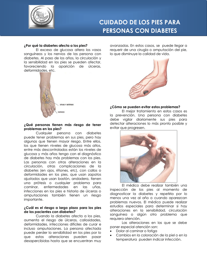 tratamiento de pies para diabetes
