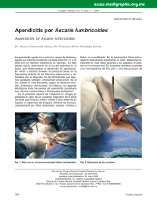 Apendicitis por Ascaris lumbricoides