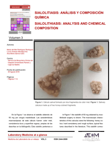 sialolitiasis: análisis y composición química sialolithiasis